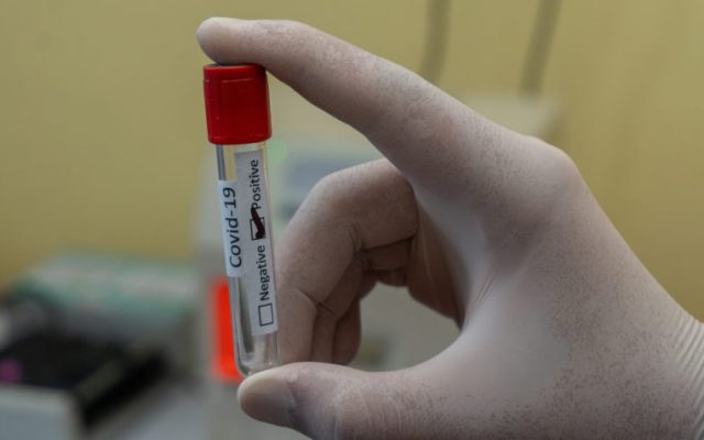 Brasil bate recorde de casos diários de covid-19 com 204,8 mil