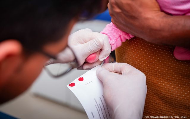 Teste do pezinho é ofertado gratuitamente nas Unidades Básicas de Saúde de Boa Vista
