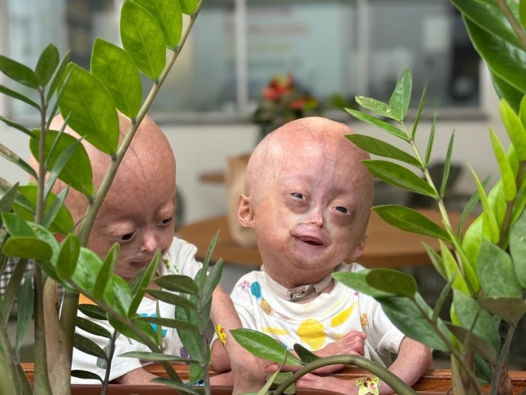 Elis e Eloá sorriem entre plantas em Boa Vista