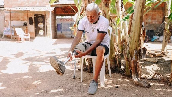 Autônomo consegue prótese com apoio da DPE-RR após amputação