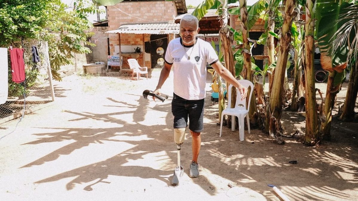 Líder comunitário de Boa Vista consegue prótese com apoio da DPE-RR