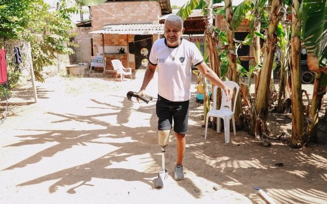 Líder comunitário de Boa Vista consegue prótese com apoio da DPE-RR